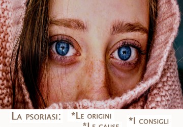 Psoriasi: origini, cause e consigli